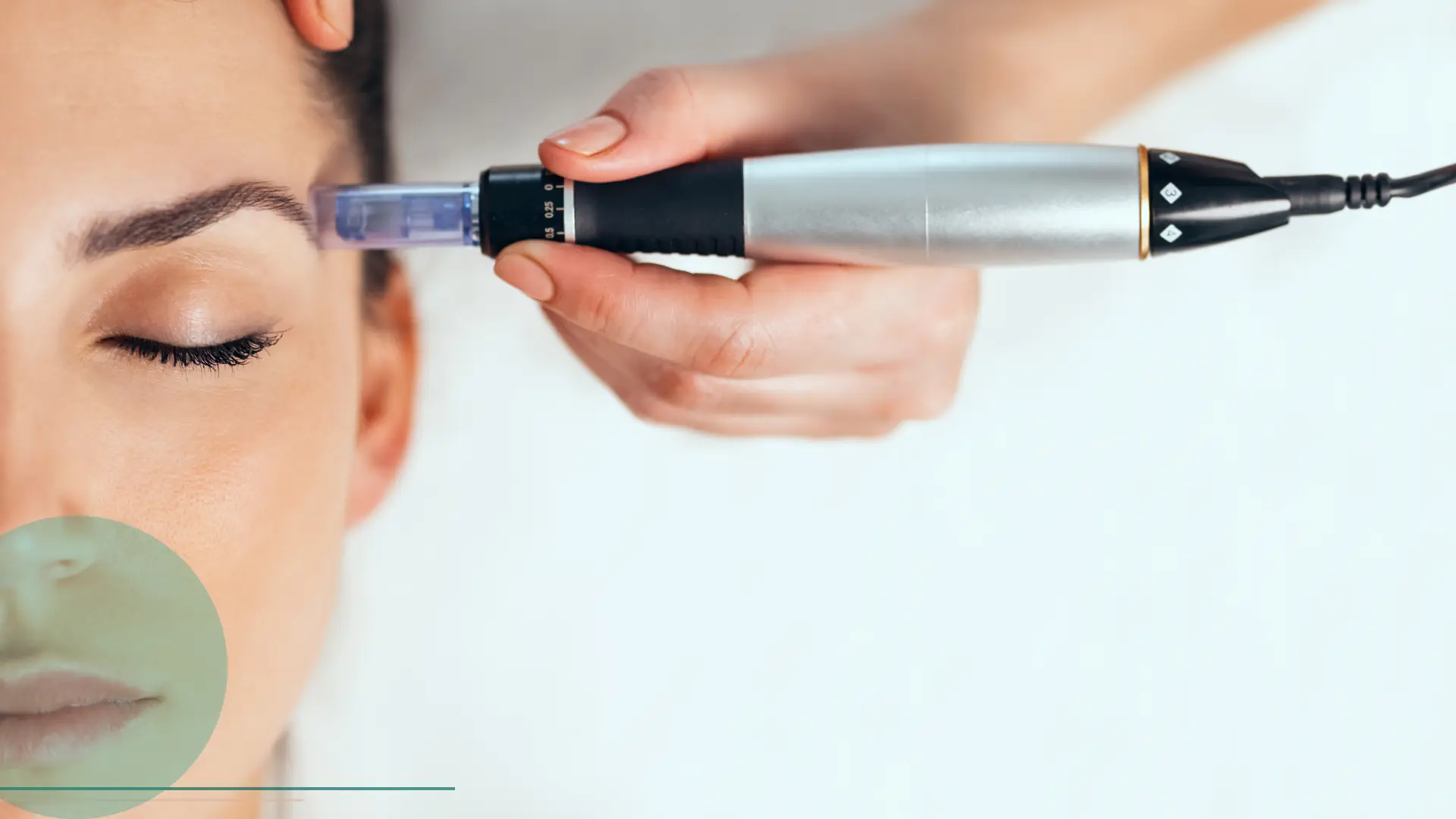 Microneedling facial rejuvenecimiento colageno