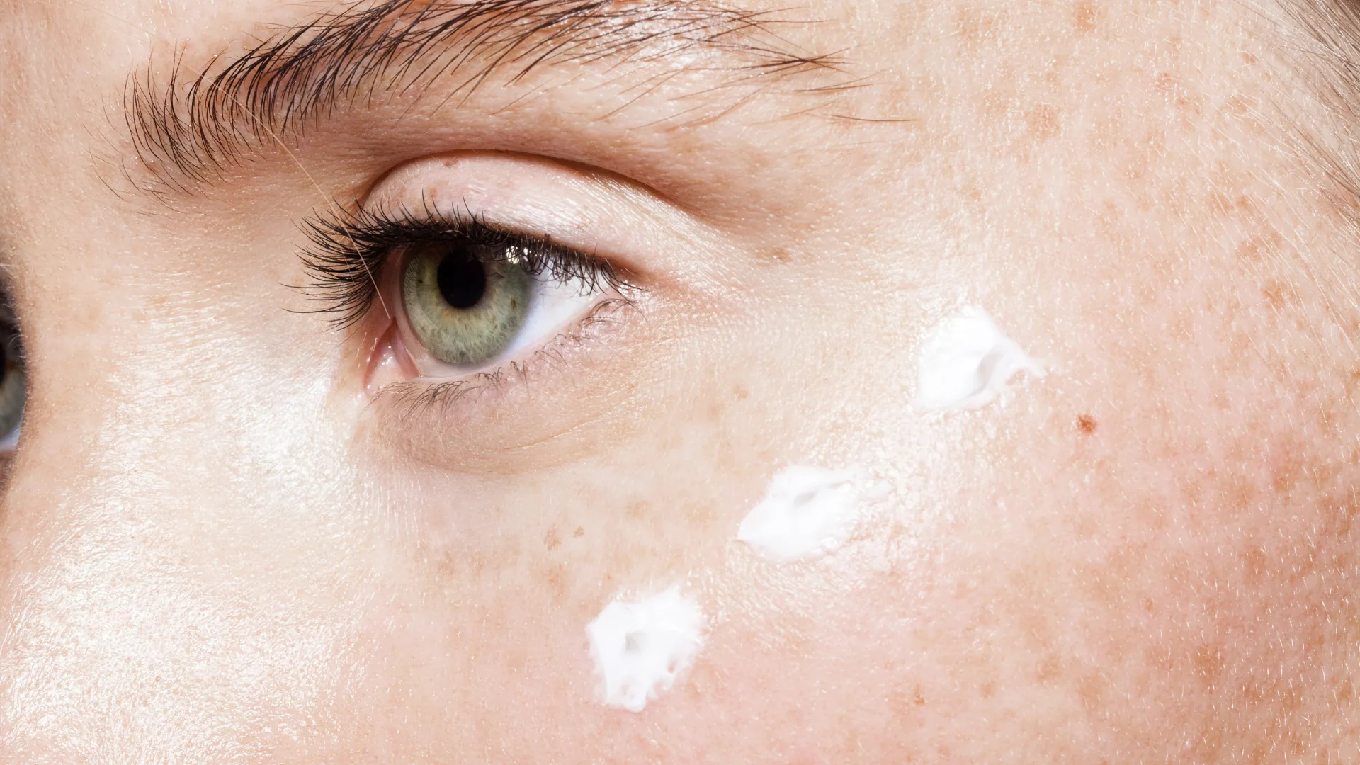 Cómo actúa el microneedling en la piel