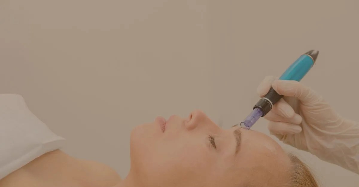 Microneedling para rejuvenecimiento y firmeza facial en Alicante