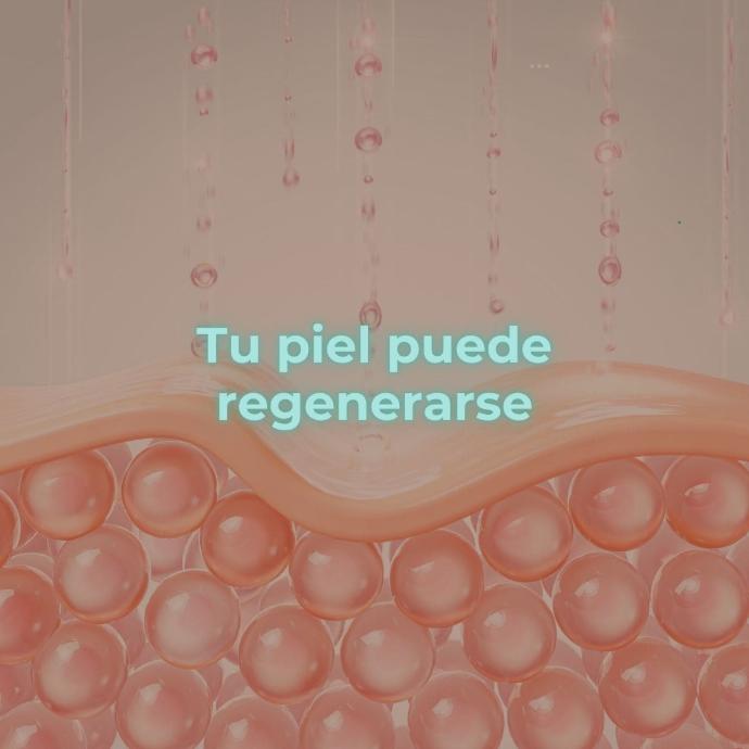 microneedling profesional